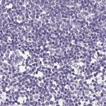 FDX1 Antibody in Immunohistochemistry (IHC)