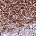 FDX1 Antibody in Immunohistochemistry (IHC)