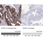 OVGP1 Antibody in Immunohistochemistry (IHC)