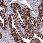 OVGP1 Antibody in Immunohistochemistry (IHC)