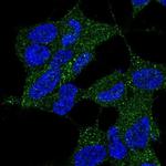 DYNC2LI1 Antibody in Immunocytochemistry (ICC/IF)