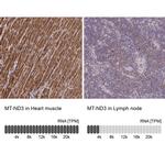 MT-ND3 Antibody in Immunohistochemistry (IHC)