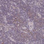 MT-ND3 Antibody in Immunohistochemistry (IHC)