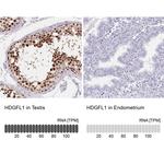 HDGFL1 Antibody in Immunohistochemistry (IHC)