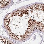 HDGFL1 Antibody in Immunohistochemistry (IHC)