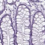 HDGFL1 Antibody in Immunohistochemistry (IHC)