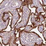 HSD17B1 Antibody in Immunohistochemistry (Paraffin) (IHC (P))