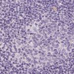 HSD17B1 Antibody in Immunohistochemistry (IHC)