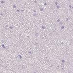 HSD17B1 Antibody in Immunohistochemistry (IHC)