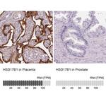 HSD17B1 Antibody