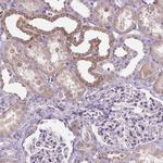 GLUT9 Antibody in Immunohistochemistry (Paraffin) (IHC (P))