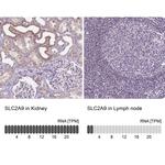 GLUT9 Antibody in Immunohistochemistry (IHC)