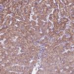 CYP3A43 Antibody in Immunohistochemistry (Paraffin) (IHC (P))