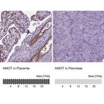 AMOT Antibody in Immunohistochemistry (IHC)