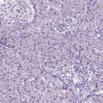 GABRB2 Antibody in Immunohistochemistry (IHC)