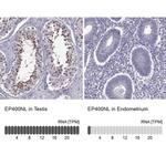 EP400NL Antibody in Immunohistochemistry (IHC)