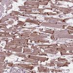 CHMP4A Antibody in Immunohistochemistry (Paraffin) (IHC (P))