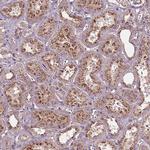 CHMP4A Antibody in Immunohistochemistry (Paraffin) (IHC (P))