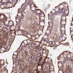 CHMP4A Antibody in Immunohistochemistry (Paraffin) (IHC (P))