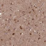 MTCO1 Antibody in Immunohistochemistry (IHC)