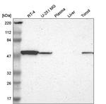 WARS Antibody in Western Blot (WB)