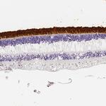 IMPG2 Antibody in Immunohistochemistry (Paraffin) (IHC (P))