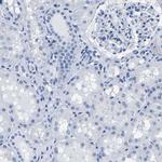 IMPG2 Antibody in Immunohistochemistry (Paraffin) (IHC (P))