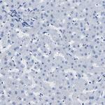 IMPG2 Antibody in Immunohistochemistry (Paraffin) (IHC (P))