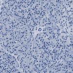 IMPG2 Antibody in Immunohistochemistry (Paraffin) (IHC (P))