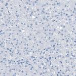 MGARP Antibody in Immunohistochemistry (Paraffin) (IHC (P))