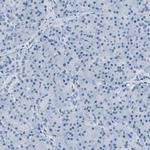 MGARP Antibody in Immunohistochemistry (Paraffin) (IHC (P))