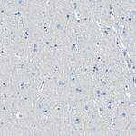 MGARP Antibody in Immunohistochemistry (IHC)