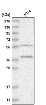 RHBDL1 Antibody in Western Blot (WB)