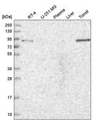 TGFBRAP1 Antibody in Western Blot (WB)