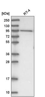 DHTKD1 Antibody in Western Blot (WB)