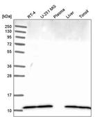 DYNLL1 Antibody in Western Blot (WB)