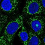 TMLHE Antibody in Immunocytochemistry (ICC/IF)