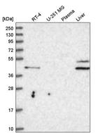 RHBG Antibody in Western Blot (WB)