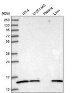 V-ATPase G1 Antibody in Western Blot (WB)