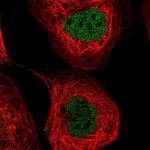 NUDT2 Antibody in Immunocytochemistry (ICC/IF)