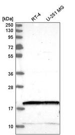 NUDT2 Antibody in Western Blot (WB)