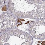 Growth Hormone Receptor Antibody in Immunohistochemistry (Paraffin) (IHC (P))