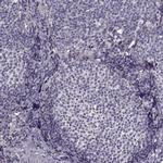 Growth Hormone Receptor Antibody in Immunohistochemistry (IHC)