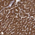 Growth Hormone Receptor Antibody in Immunohistochemistry (IHC)