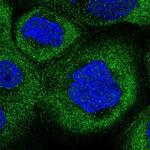 COLQ Antibody in Immunocytochemistry (ICC/IF)