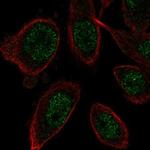 ZNF664 Antibody in Immunocytochemistry (ICC/IF)