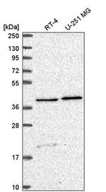 SLC18B1 Antibody in Western Blot (WB)