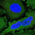 NCKIPSD Antibody in Immunocytochemistry (ICC/IF)