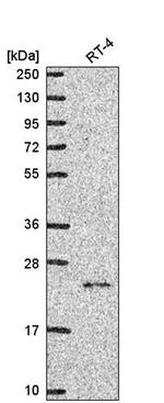 NCKIPSD Antibody in Western Blot (WB)