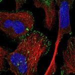 TRIM62 Antibody in Immunocytochemistry (ICC/IF)